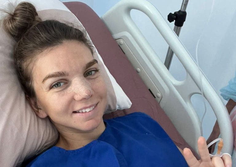 Simona Halep presenta su «nueva» nariz tras pasar por cirugía estética